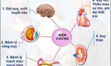 Đồng mắc đái tháo đường và tăng huyết áp, dùng thuốc như thế nào?