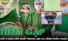 Cắt u gan khủng nhất trong hơn 300 ca bệnh viện từng tiếp nhận