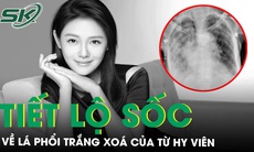 Bác sĩ tiết lộ gây sốc về lá phổi trắng xoá của Từ Hy Viên 