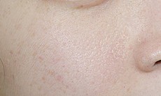 Các bước cấp ẩm cho da khô