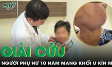 ‘Giải cứu’ người phụ nữ 59 tuổi hơn 10 năm khổ sở vì khối u trên mặt