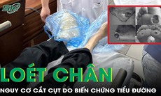 Biến chứng bệnh tiểu đường, người đàn ông bị loét chân, nguy cơ phải cắt cụt 