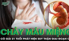 Cô gái 21 tuổi bàng hoàng phát hiện suy thận giai đoạn cuối sau triệu chứng chảy máu miệng