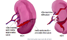 Bài tập tốt cho người sau chấn thương lách