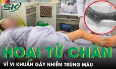 Nhiễm trùng máu, hoại tử chân chỉ vì vết xước sau cú ngã 