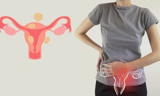 Chảy máu khi rụng trứng có nguy hiểm không?