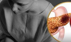 Người phụ nữ qua đời vì từ chối điều trị ung thư, tin vào thực dưỡng