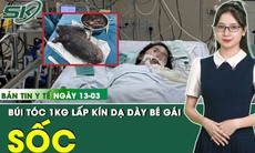 Bản tin Y tế 13/3: Búi tóc khổng lồ gần 1 kg lấp kín dạ dày bé gái 12 tuổi
