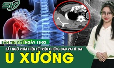 Bản Tin Y Tế 18/3: Đau vai, tê bì cánh tay, bất ngờ phát hiện khối u xương cực hiếm 