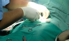 Thủ thuật cắt bao quy đầu có rủi ro và biến chứng tiềm ẩn gì?