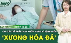 Bản Tin Y Tế 19/3: Cô gái trẻ phải thay khớp háng vì bệnh xương hóa đá 