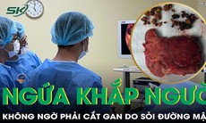 Ngứa khắp người tưởng bệnh ngoài da, không ngờ phải cắt gan vì sỏi đường mật