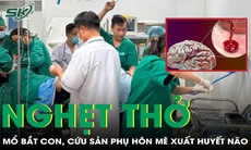 Bác sĩ kể lại giây phút sinh tử giành sự sống cho sản phụ xuất huyết não nguy kịch