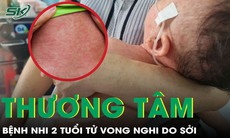 Thương tâm: Bệnh nhi 2 tuổi tử vong nghi do biến chứng sởi