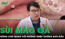 Triệu chứng cảnh báo sùi mào gà ở nam giới
