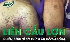 Người đàn ông nhiễm liên cầu lợn vì sở thích ăn tiết canh, đồ tái sống