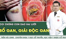 [LIVE] Bổ gan, giải độc gan - Coi chừng con dao hai lưỡi