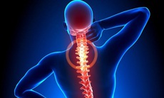 Hẹp ống sống: Nguyên nhân, biểu hiện, cách điều trị và phòng bệnh