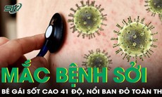 Bé gái 14 tuổi sốt cao 41 độ C, phát ban toàn thân do mắc sởi