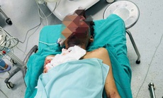 Học sinh lớp 6 bị nát bàn tay do chế tạo pháo