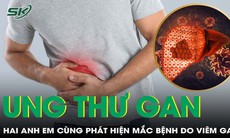 Hai anh em cùng phát hiện ung thư gan, người em ở giai đoạn muộn