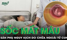Cứu kịp thời sản phụ sốc mất máu do thai ngoài tử cung vỡ dính chặt đại tràng