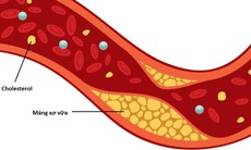 5 chất dinh dưỡng giúp loại bỏ cholesterol xấu