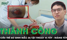 Cứu sống trẻ sơ sinh mắc dị tật thoát vị tủy - màng tủy nguy kịch