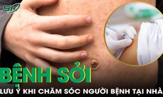 Chăm sóc người mắc sởi tại nhà, những điều cần đặc biệt lưu ý