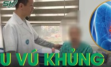 Mang u vú 5 năm không chữa, cụ bà 85 tuổi cấp cứu do loét mủ chảy máu