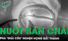 Pha ‘giải cứu’ nghẹn họng bất thành, người phụ nữ nuốt cả bàn chải đánh răng