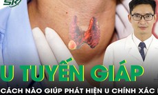 Cách nào phát hiện u tuyến giáp chính xác nhất?