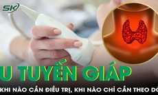 Phát hiện u tuyến giáp: Khi nào cần điều trị, khi nào chỉ cần theo dõi?