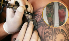 Xăm kín 2 cẳng chân, nam thanh niên nhập viện vì vùng mực đỏ bỗng sưng rát