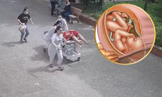 Sản phụ nguy kịch vì sa dây rốn, được cứu sống thần kỳ trong 5 phút