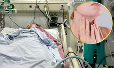 Sốt, đau họng tưởng cảm cúm, nữ sinh nguy kịch chỉ sau một ngày nhập viện