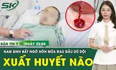 Bản tin Y tế 22/4: Đau đầu dữ dội kèm nôn mửa, nam sinh nguy kịch vì xuất huyết não