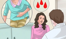 Mãn kinh uống nước cốt chanh liều cao có kinh trở lại - 'hồi xuân' hay cảnh báo bất thường?