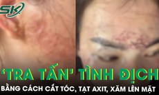 Công an vào cuộc vụ đánh ghen bằng cách cắt tóc, tạt axit, xăm lên mặt ‘tình địch’ ở Cà Mau