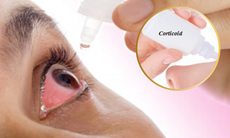 Nguy cơ mù lòa từ thói quen tự ý dùng thuốc nhỏ mắt chứa corticoid