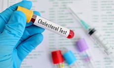 Bất ngờ với 5 loại thực phẩm giúp kiểm soát cholesterol hiệu quả