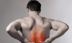 Các thuốc điều trị bệnh viêm cột sống dính khớp