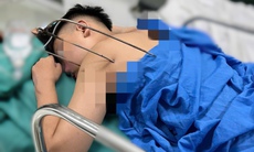 Thanh niên 17 tuổi nguy kịch do dị vật kim loại tự chế xuyên thấu tim 