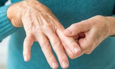 Người bệnh viêm khớp dạng thấp có nên tập thể dục?
