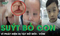 Suýt không được chào đời vì dị tật hở môi, bé trai trở thành niềm tự hào của gia đình