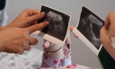 Rút ngắn hành trình tìm con của các cặp vợ chồng vô sinh hiếm muộn