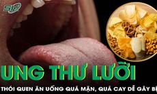 Ăn quá mặn, quá cay có thể dẫn đến nguy cơ mắc ung thư lưỡi!