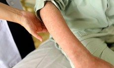 Người lớn mắc sởi cũng có thể đối mặt với những biến chứng ảnh hưởng sức khỏe lâu dài
