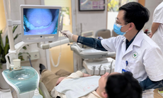 Câu hỏi thường gặp về lưỡi bản đồ