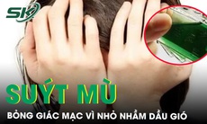 Bỏng giác mạc, suýt mù mắt vì nhỏ nhầm dầu gió